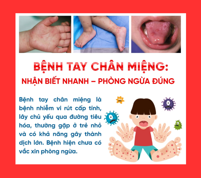 [Infographic] Bệnh tay chân miệng - nhận biết nhanh, phòng ngừa đúng